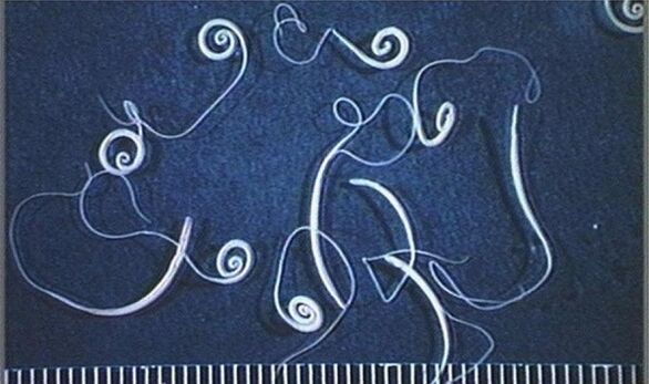 insan vücudundaki kırbaç kurtları